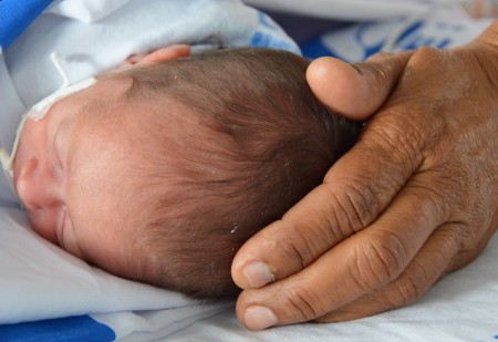 Segundo o Ministério da Saúde, a microcefalia é determinada pelo perímetro cefálico do bebê: igual ou menor que 31,9 cm (meninos) e igual ou menor que 31,5 cm (meninas) 