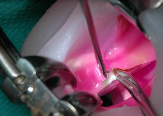 Simulador de fissura labiopalatal de alta fidelidade (Foto: Divulgação)