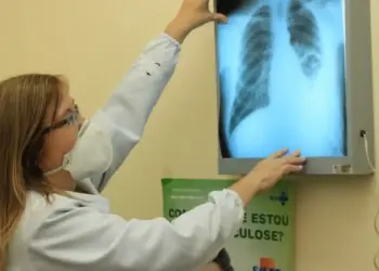 Saúde de Salvador  alerta para tuberculose e reforça importância de diagnóstico precoce