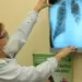 Saúde de Salvador alerta para tuberculose e reforça importância de diagnóstico precoce